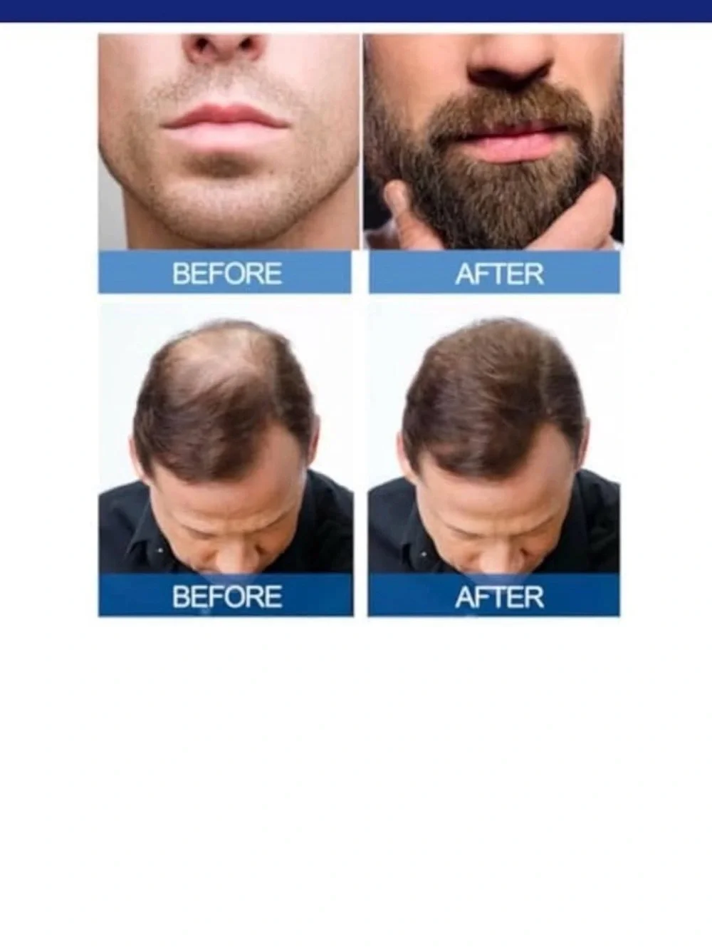 Kirkland Signature Minoxidil 5% Topical Solution for Men - Blue